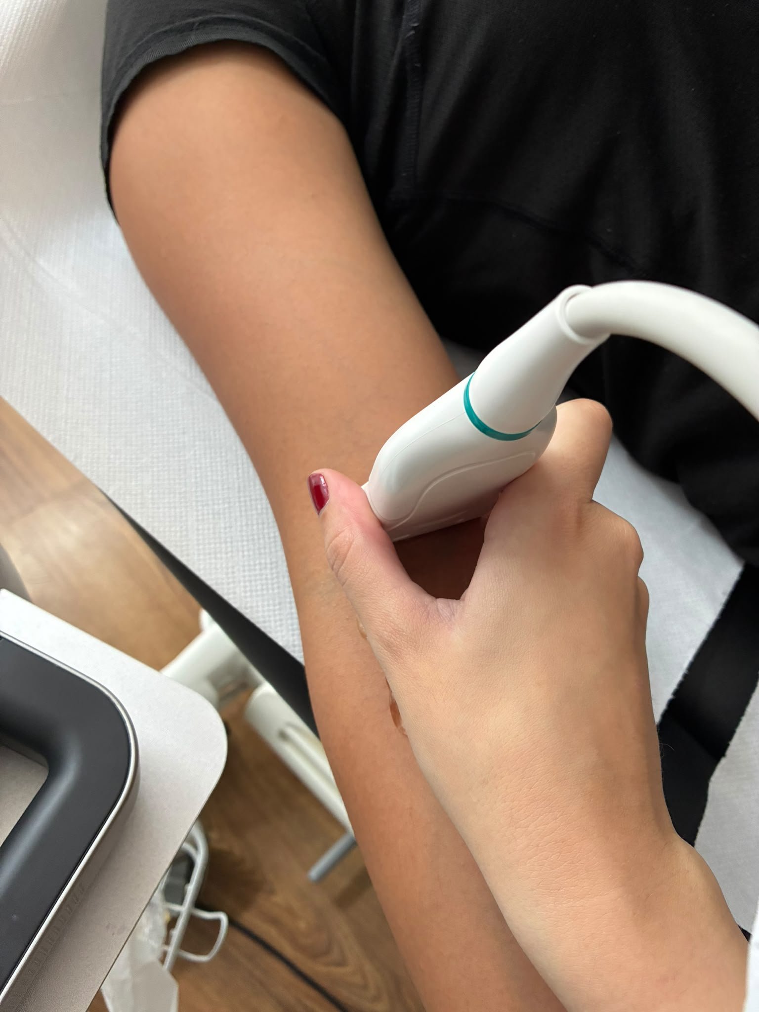 Sonda de ecografía aplicada en el brazo