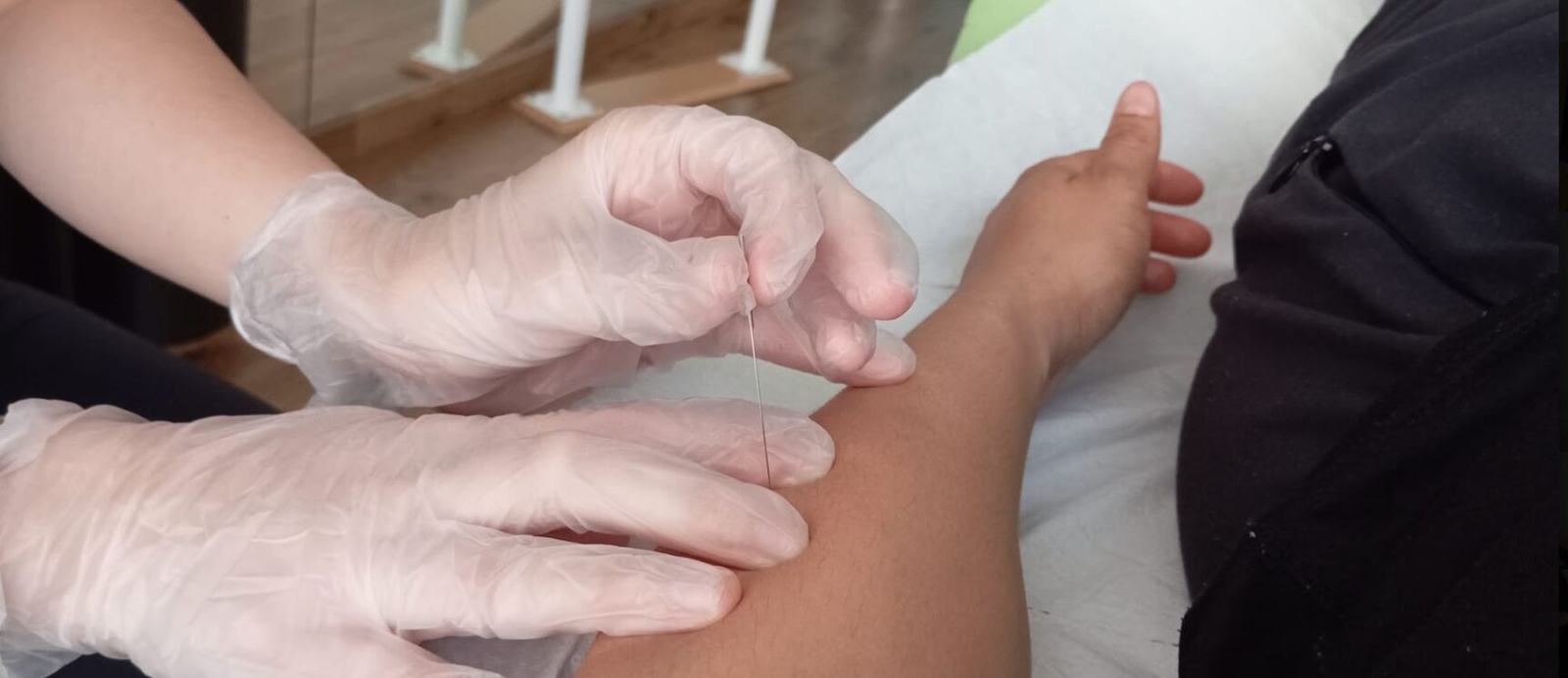 Tratamiento de punción seca en la clínica, con las manos de la fisioterapeuta y el brazo de la paciente